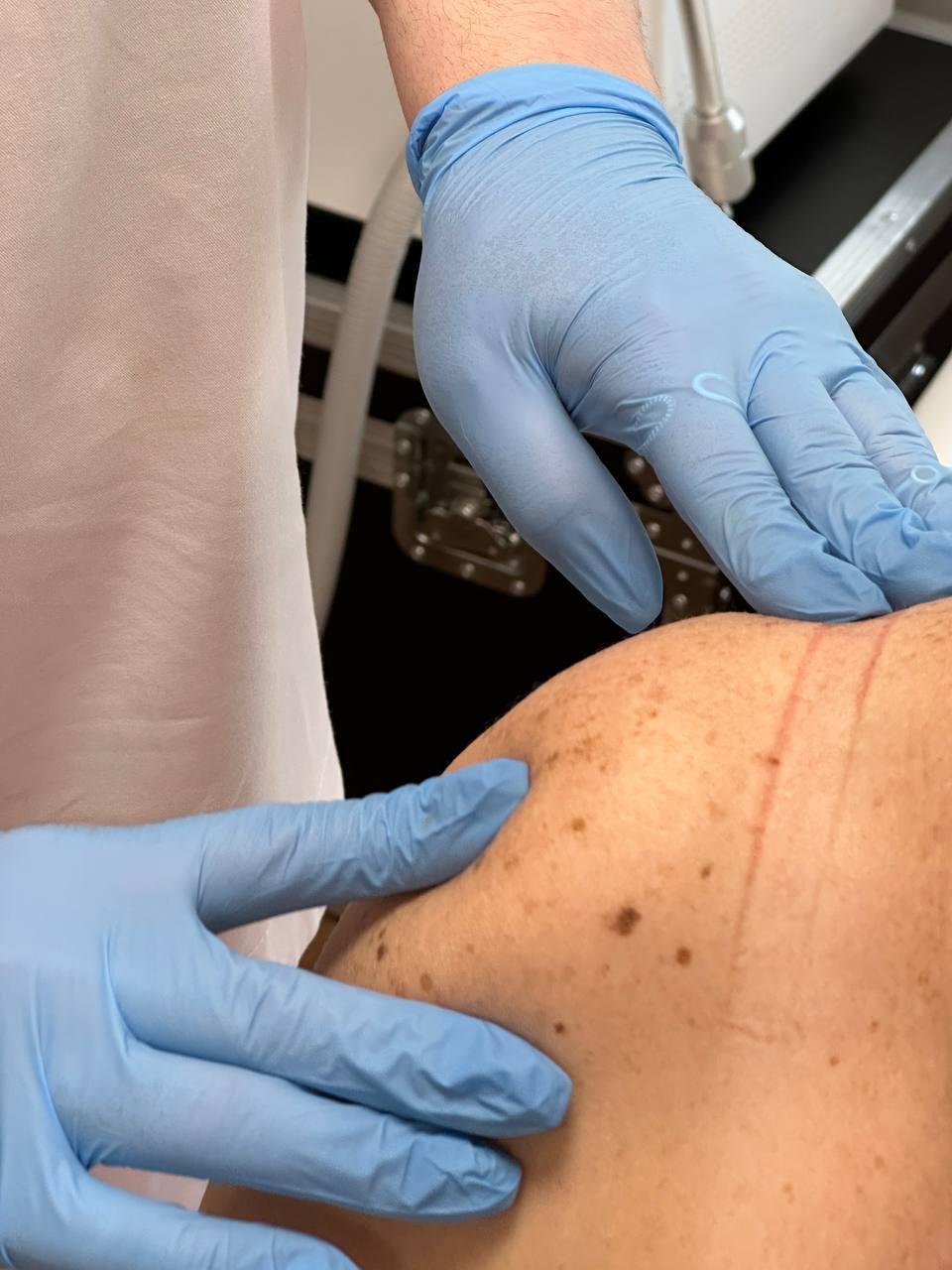 Осмотр спины пациента на приёме невролога